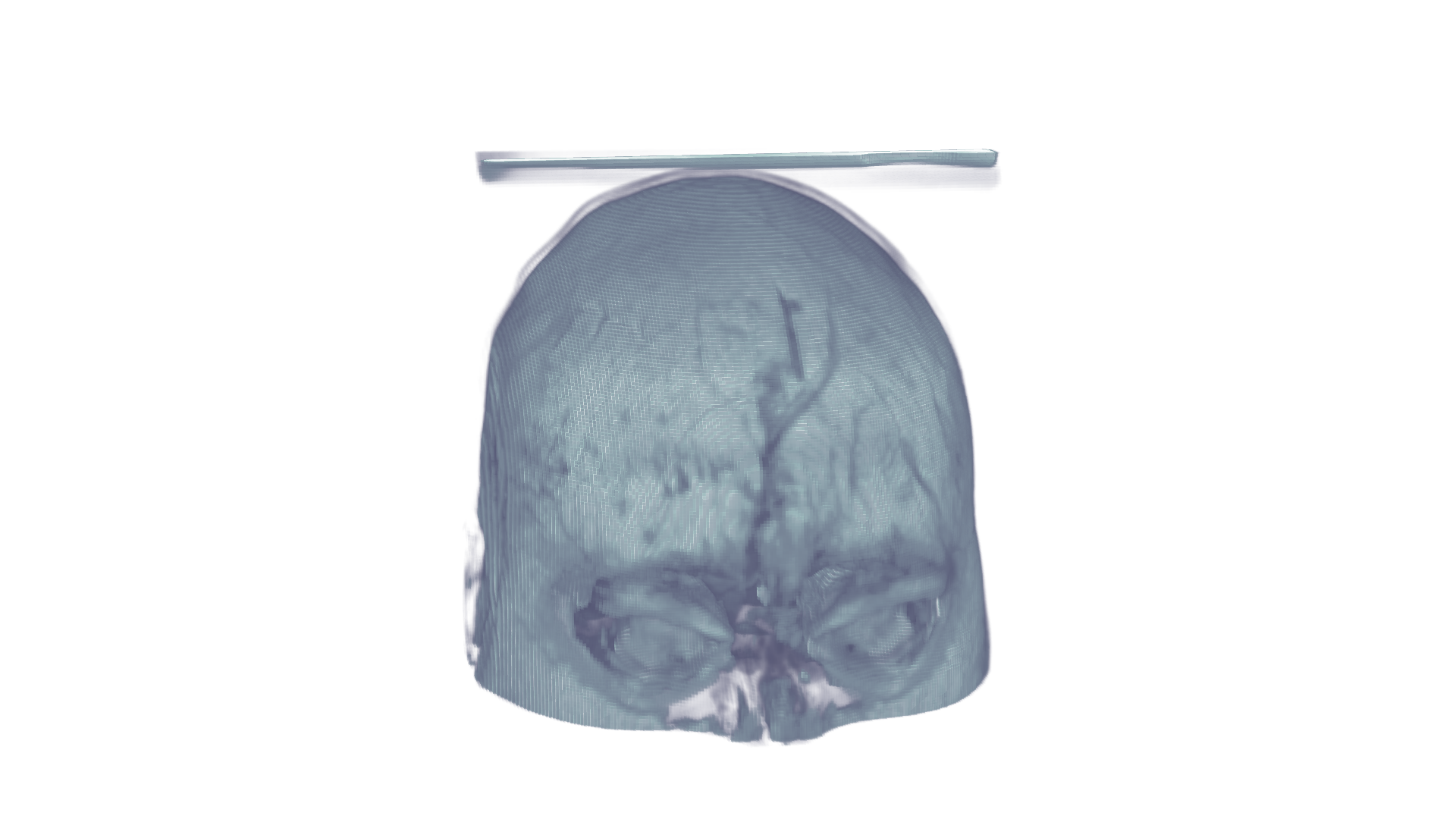 Human head MRI